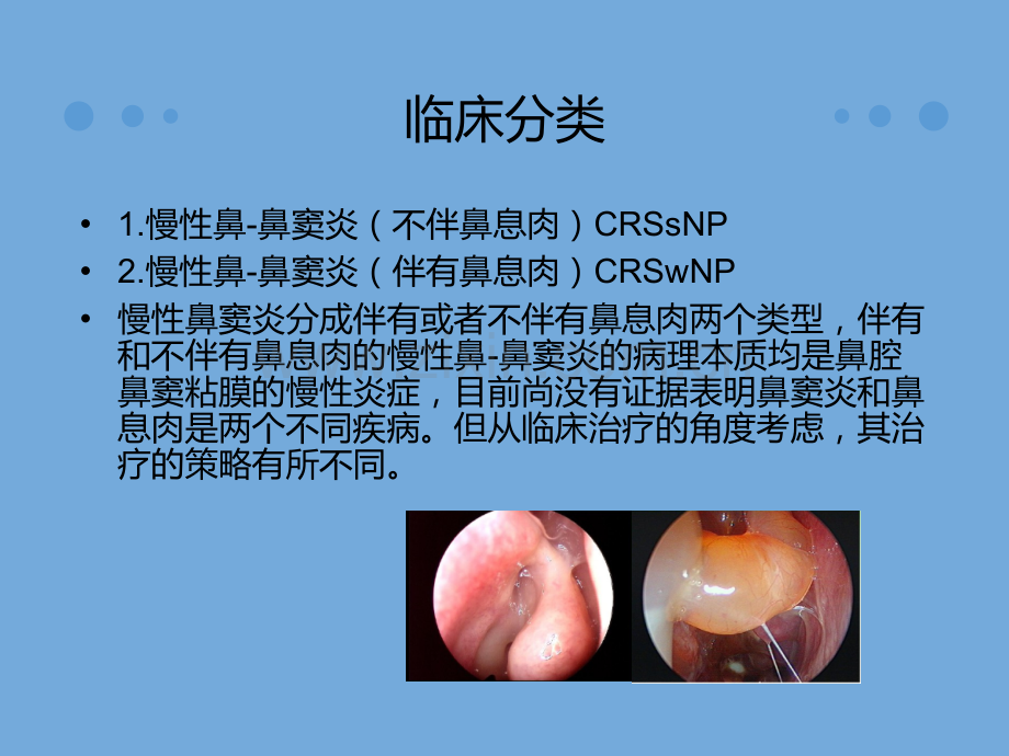 慢性鼻鼻窦炎诊治及预后.pptx_第3页