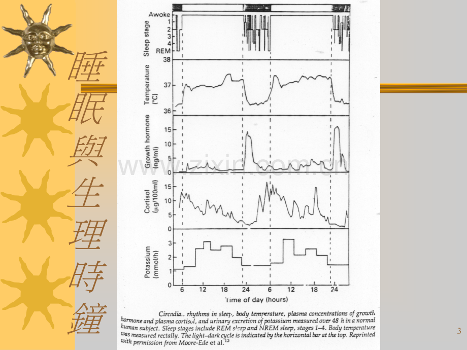 常见睡眠障碍.pptx_第3页