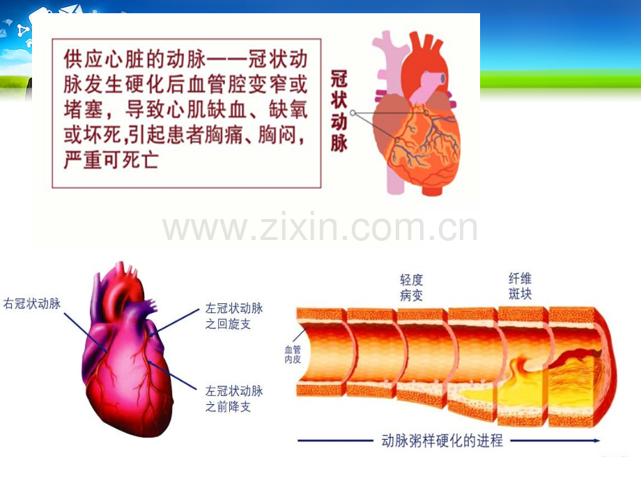 冠心病的康复主要内容.pptx_第3页