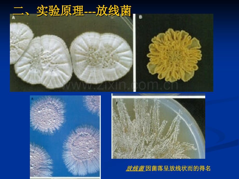 微生物实验四放线菌、霉菌、酵母菌的形态观察.pptx_第3页