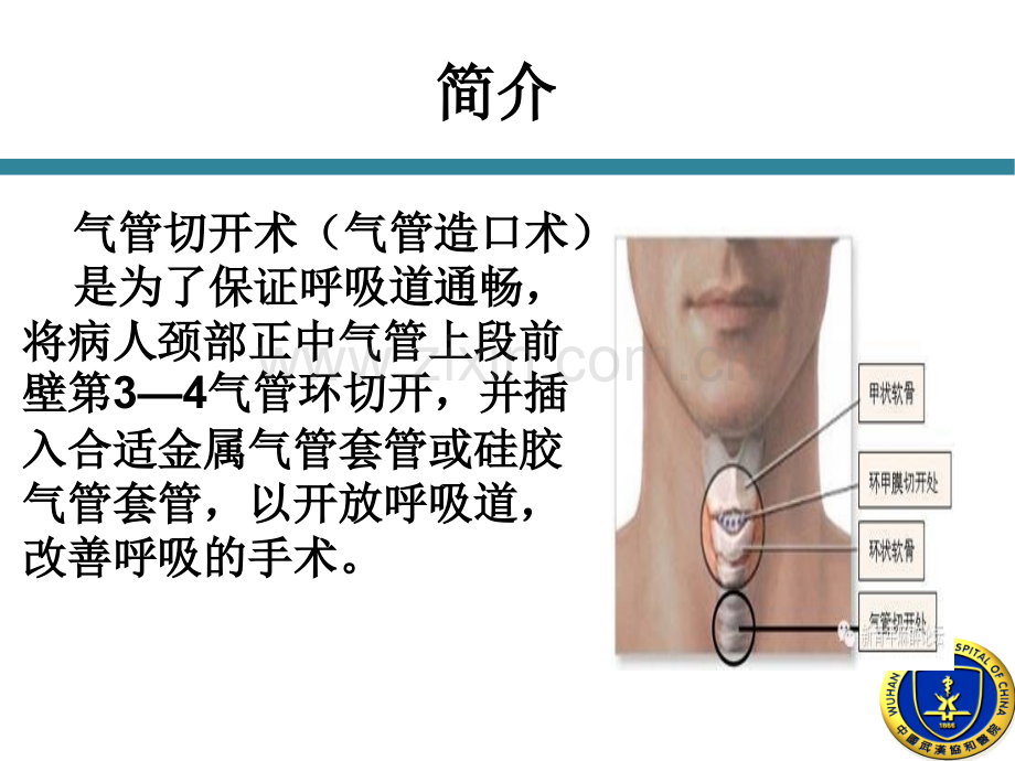 气管切开护理1PPT.pptx_第3页