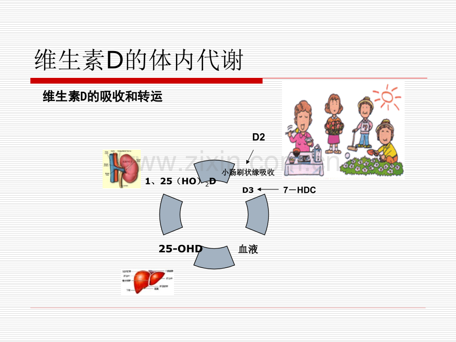 小儿佝偻病的护理.pptx_第3页