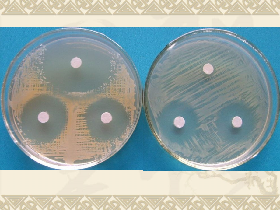 微生物实验6.pptx_第2页