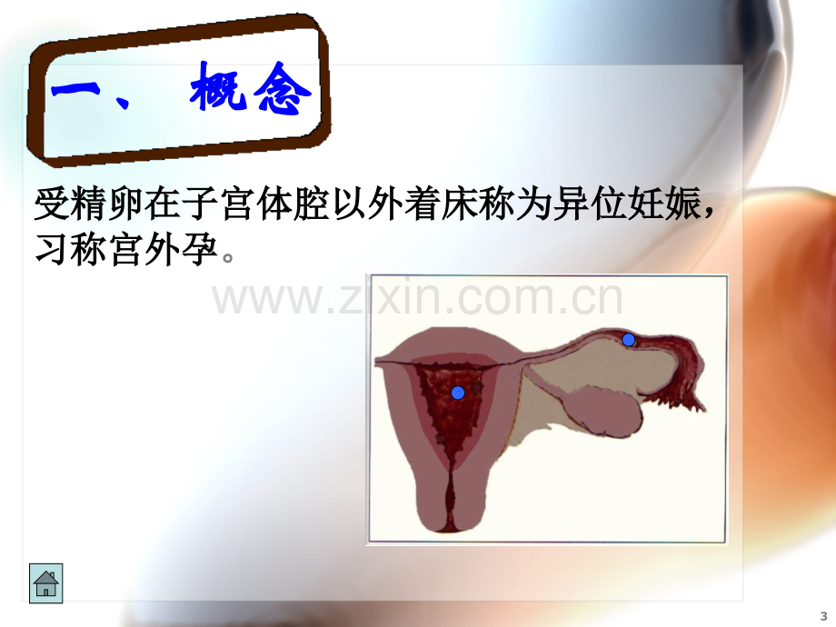 宫外孕课件.pptx_第3页