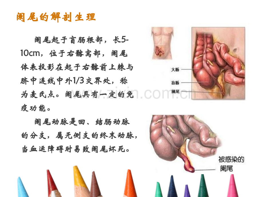 护理查房急性阑尾炎.pptx_第3页