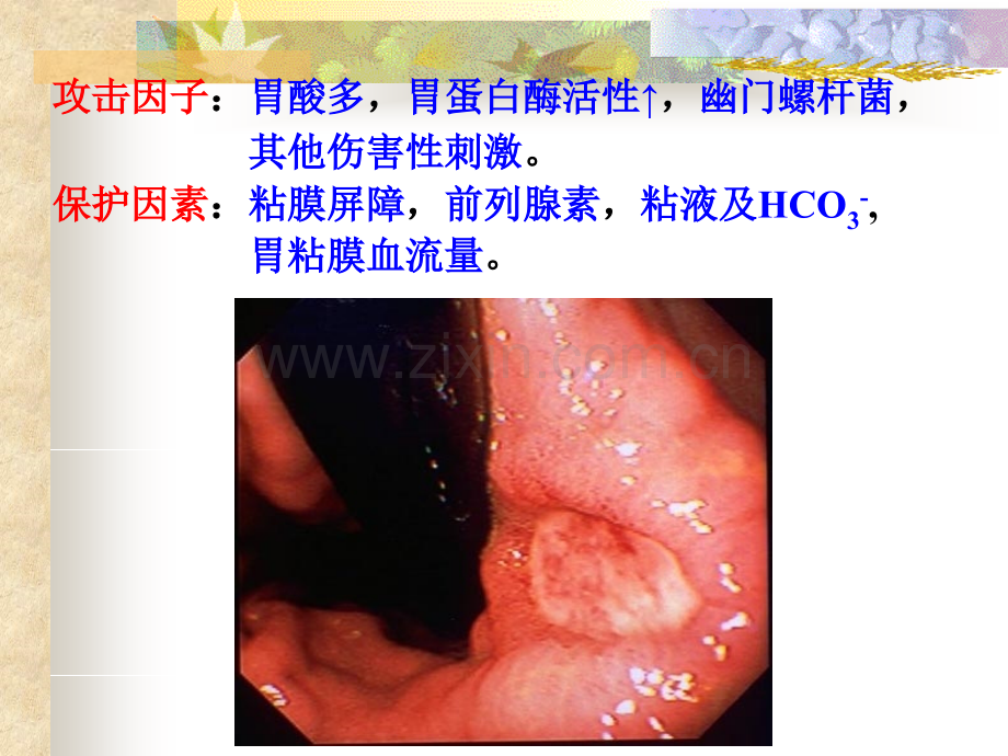 抑制胃酸分泌.pptx_第3页