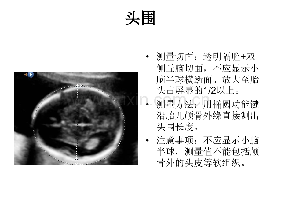 产科超声标准切面25张图.pptx_第2页