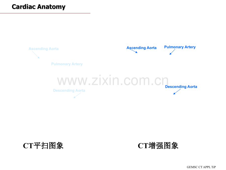 CT心脏断面解剖NXPowerLite.pptx_第3页