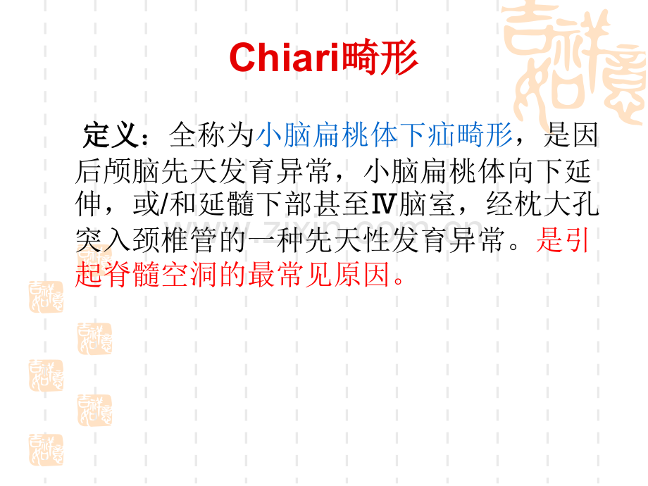 Chiari畸形并发脊髓空洞症.pptx_第1页