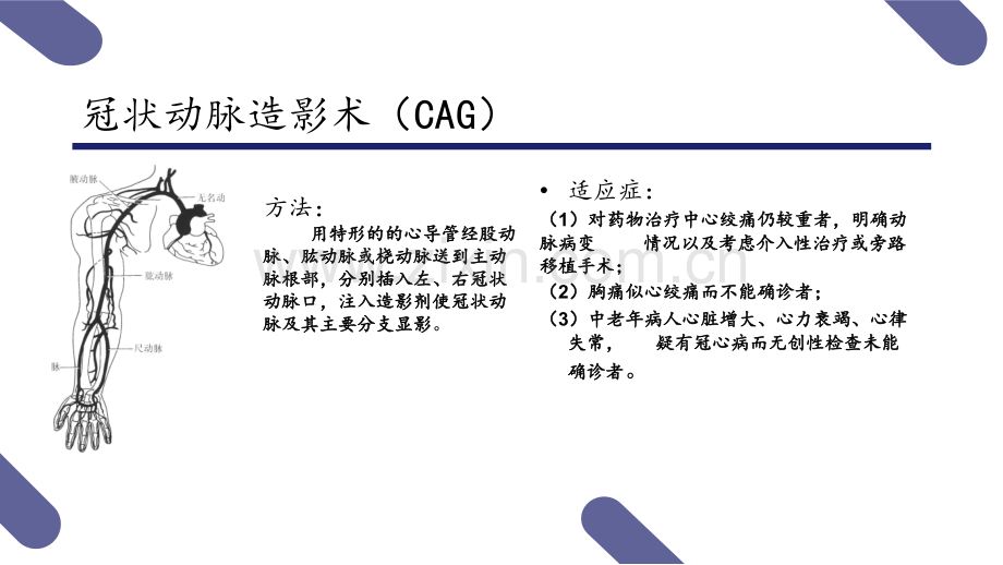 PCI术健康教育.pptx_第3页