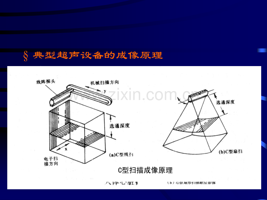 b超超声设备成像原理知识重点.pptx_第1页