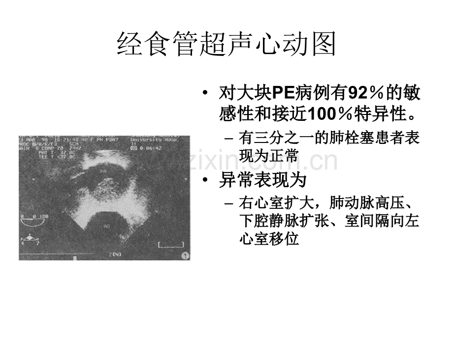 APE的影像学检查.pptx_第3页