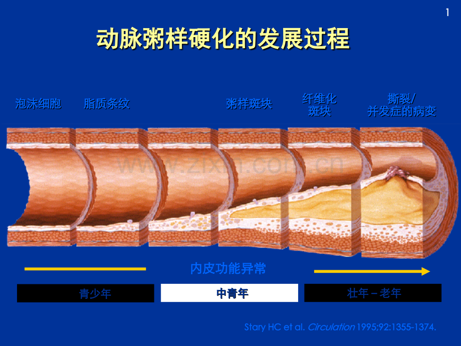 B阻滞剂与冠心病治疗.pptx_第2页