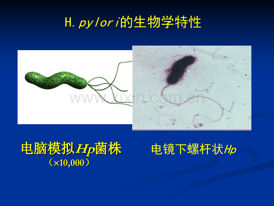 Hp感染的诊断方法.pptx_第2页