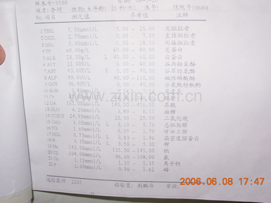 2肝功能检查.pptx_第3页