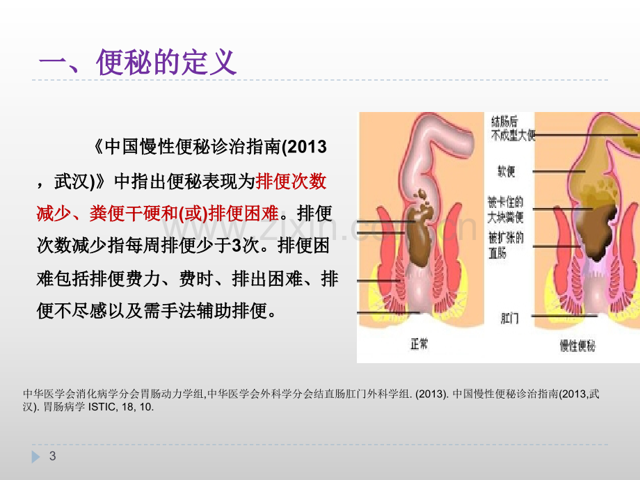 便秘的研究进展及护理措施.pptx_第3页