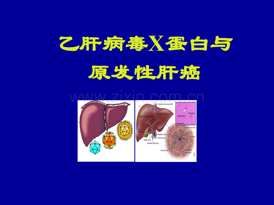 HBVX蛋白与原发性肝癌.pptx_第1页