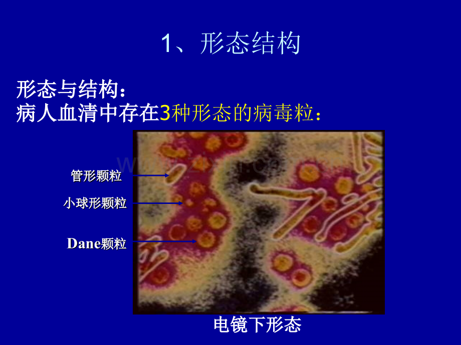 HBVX蛋白与原发性肝癌.pptx_第3页