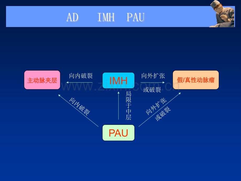 主动脉夹层壁间血肿及穿通性溃疡的影像诊断与鉴别诊断.pptx_第3页