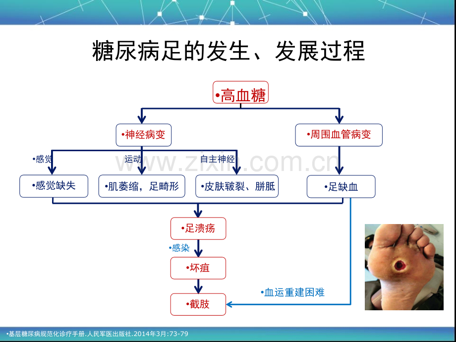 中国糖尿病足诊治指南.pptx_第2页