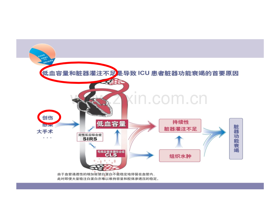 PiCCO在创伤中的价值.pptx_第3页