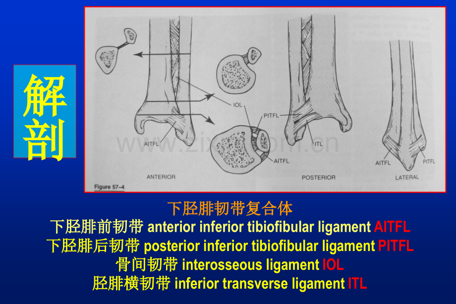 下胫腓联合损伤的诊治.pptx_第2页