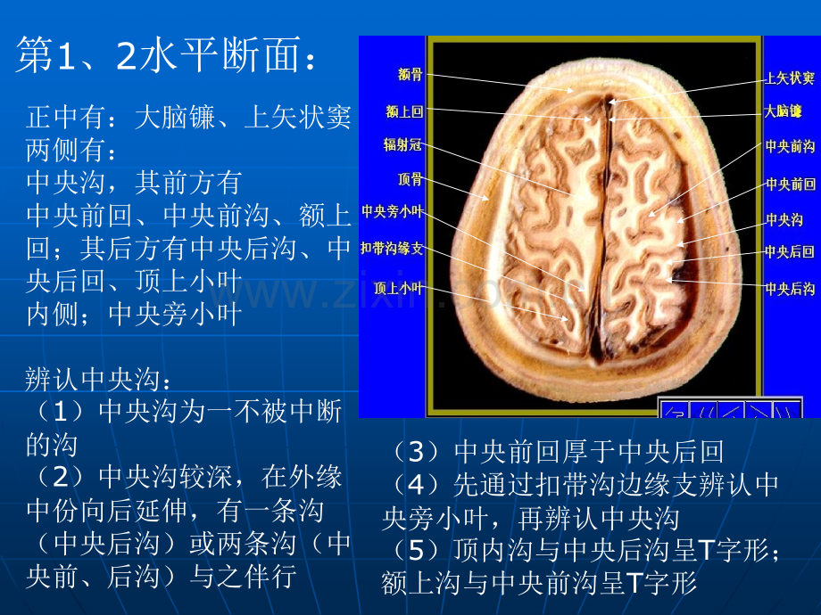 2头部断面1.pptx_第2页