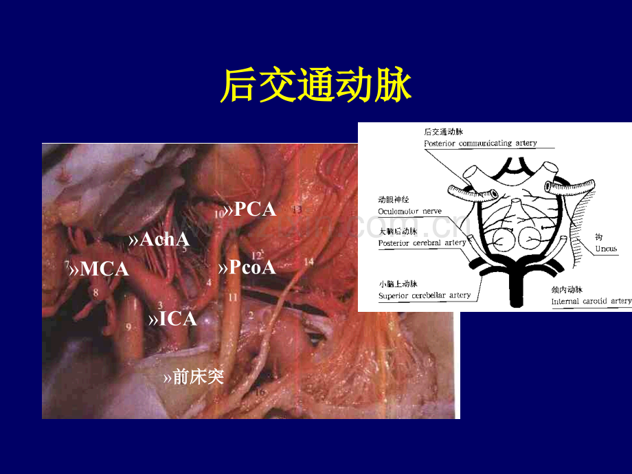 丘脑底节区脑血管解剖.pptx_第3页