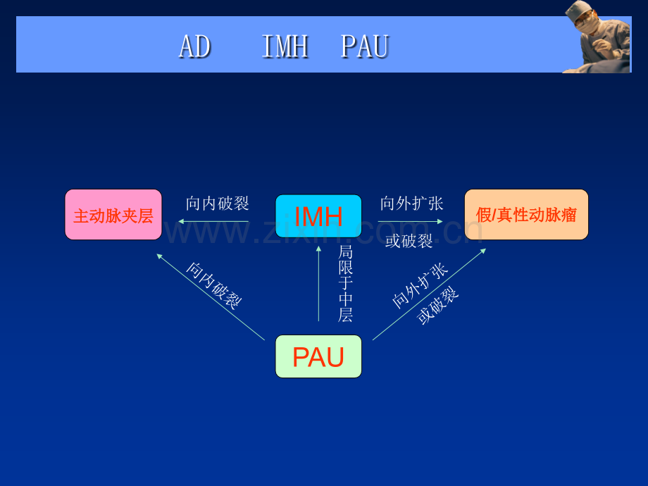 主动脉夹层壁间血肿及穿通.pptx_第3页