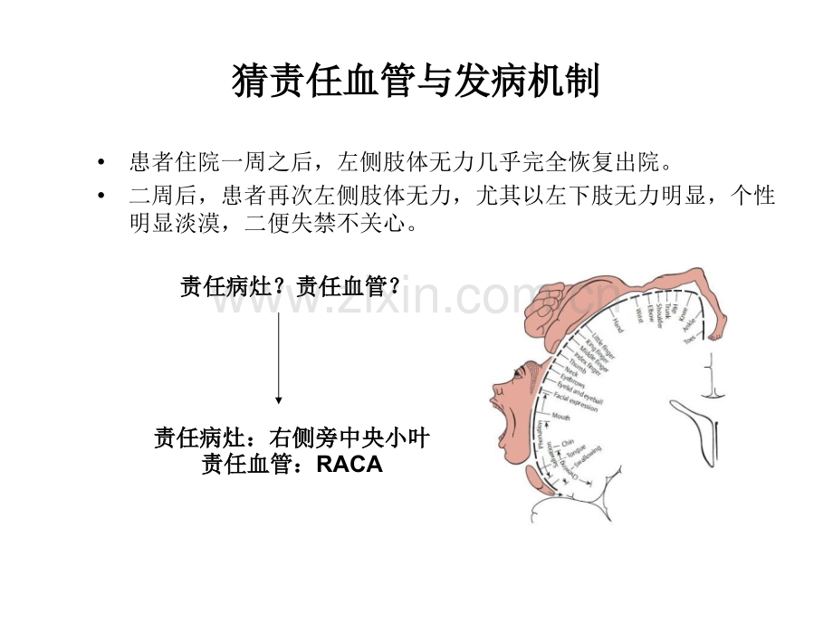 从影像学梗死部位推测责任血管和发病机制.pptx_第3页