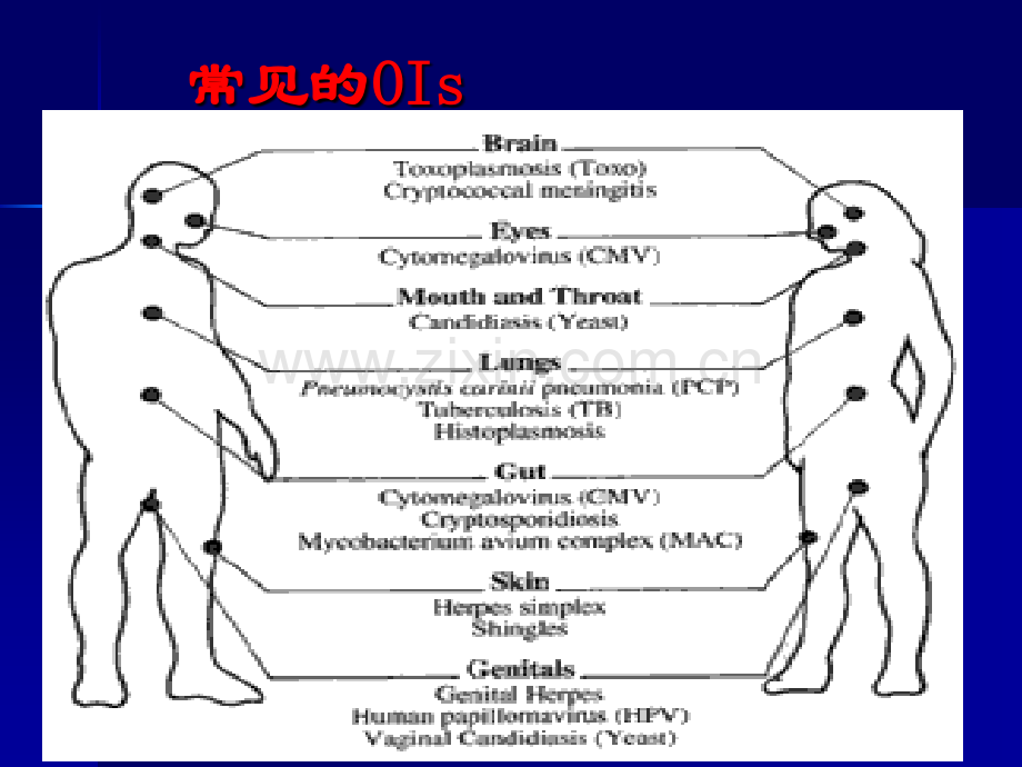 hiv机会感染治疗文档.pptx_第1页