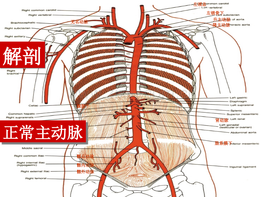 主动脉夹层的介入治疗与护理.pptx_第3页