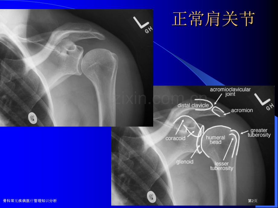 骨科常见疾病医疗管理知识分析.pptx_第2页