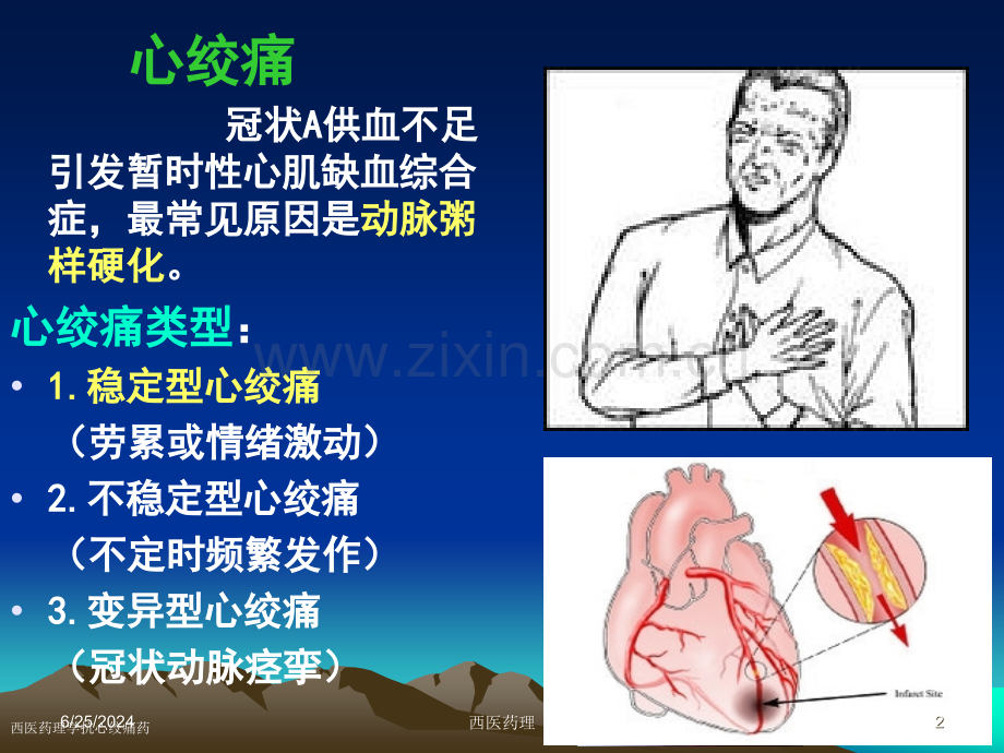 西医药理学抗心绞痛药专家讲座.pptx_第2页