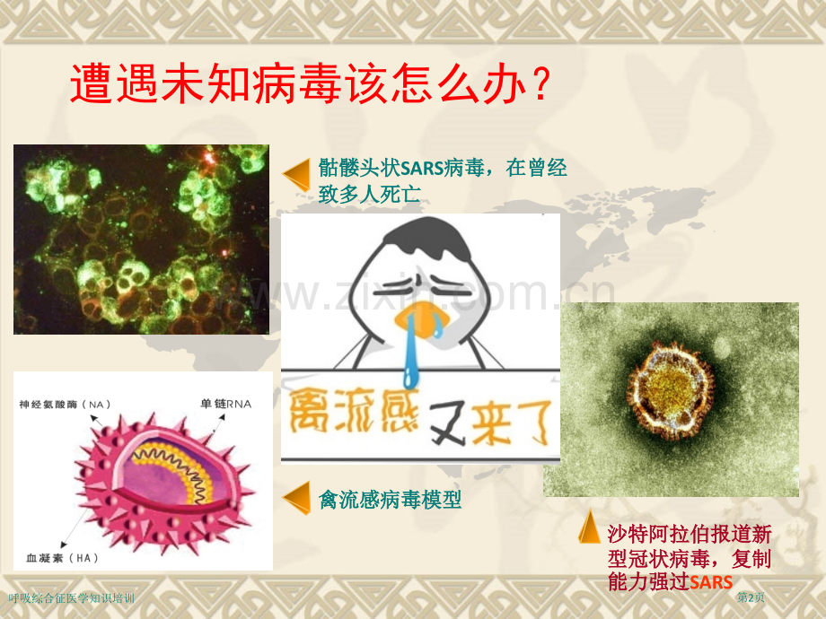 呼吸综合征医学知识培训专家讲座.pptx_第2页