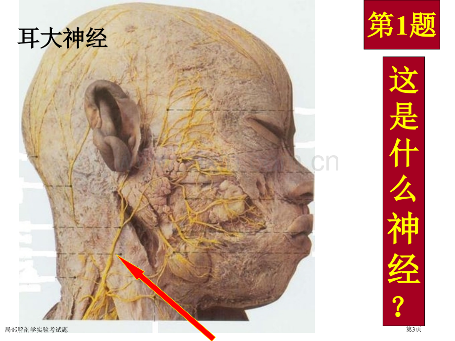 局部解剖学实验考试题专家讲座.pptx_第3页