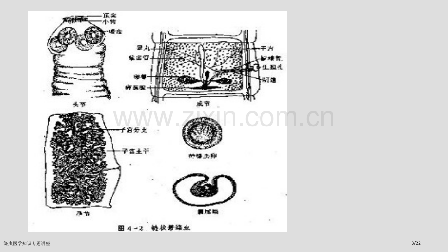 绦虫医学知识专题讲座.pptx_第3页