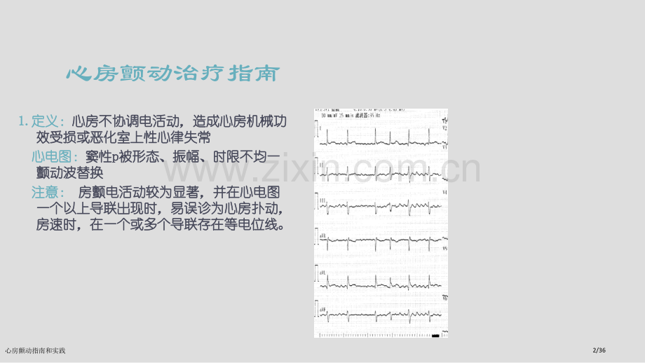 心房颤动指南和实践.pptx_第2页