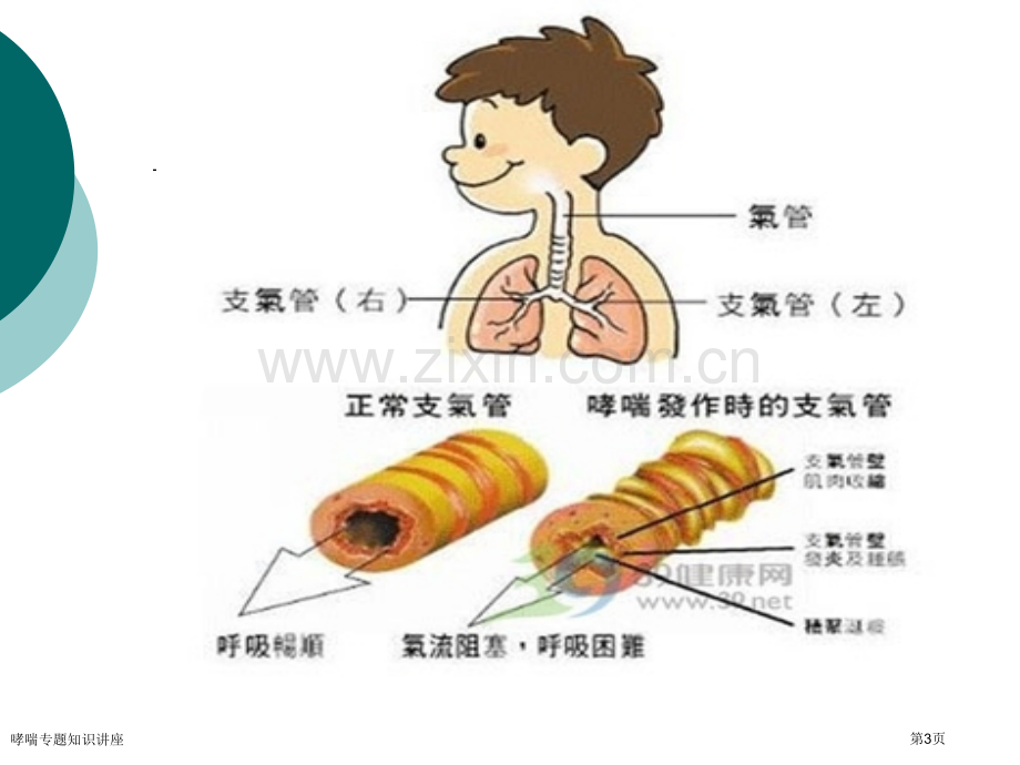 哮喘专题知识讲座专家讲座.pptx_第3页