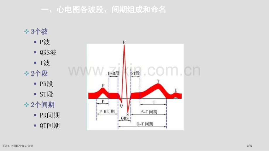 正常心电图医学知识宣讲.pptx_第3页