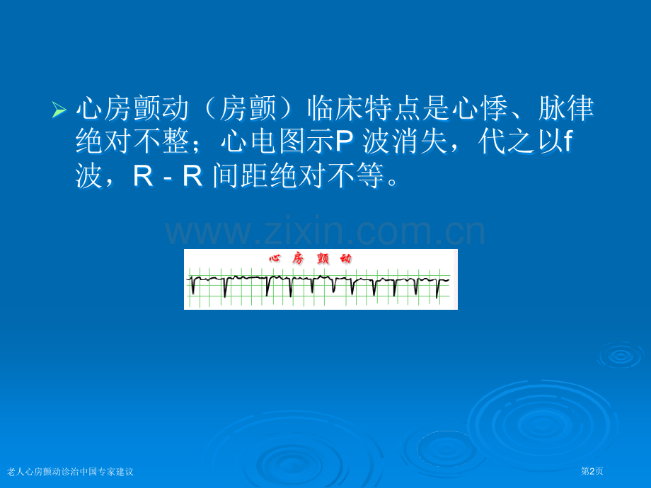 老人心房颤动诊治中国专家建议专家讲座.pptx_第2页