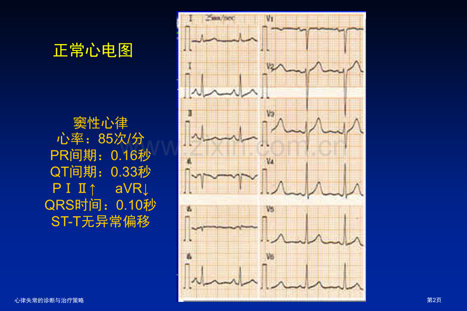 心律失常的诊断与治疗策略专家讲座.pptx_第2页