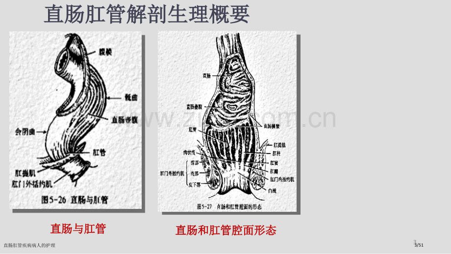 直肠肛管疾病病人的护理.pptx_第3页