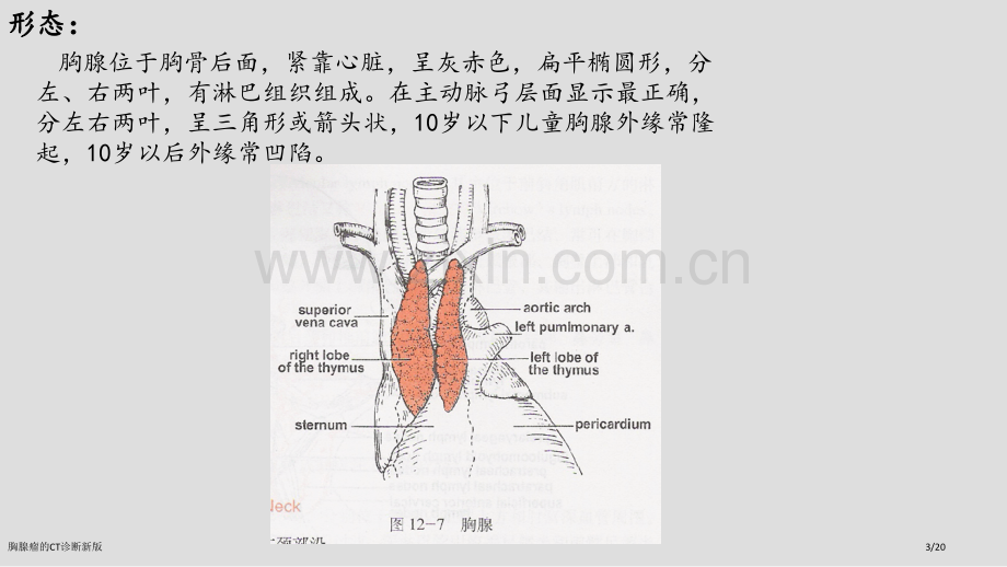 胸腺瘤的CT诊断新版.pptx_第3页