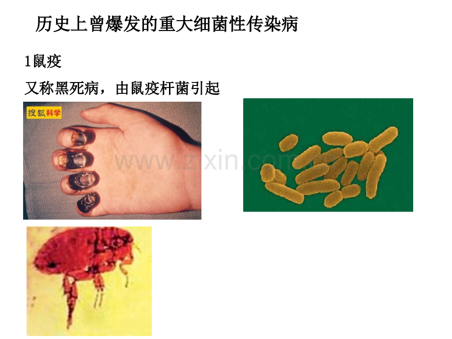 5历史上爆发的细菌性传染病解析.pptx_第1页