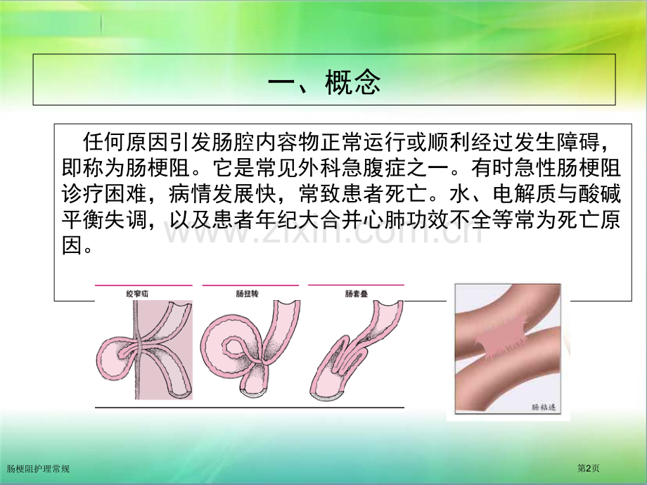 肠梗阻护理常规.pptx_第2页