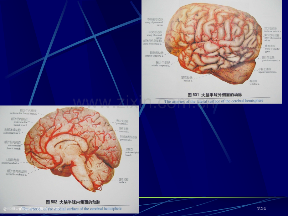 老年痴呆的临床表现和治疗护理专家讲座.pptx_第2页