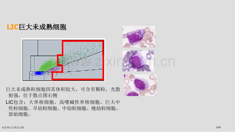 血常规五分类直方图.pptx_第2页