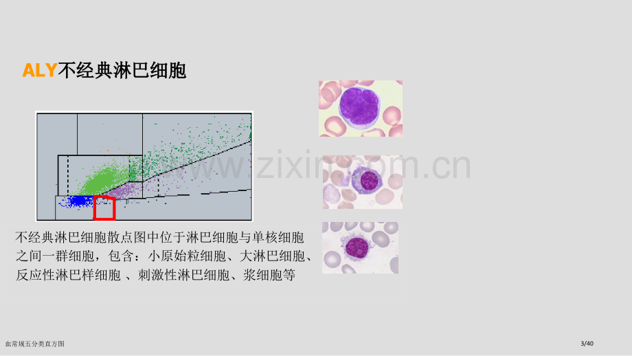 血常规五分类直方图.pptx_第3页