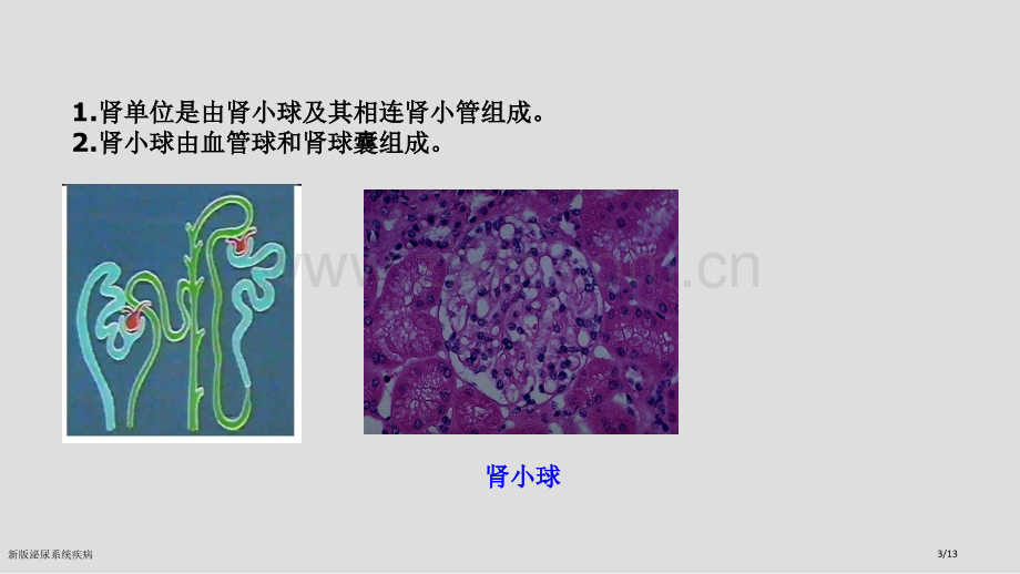 新版泌尿系统疾病.pptx_第3页